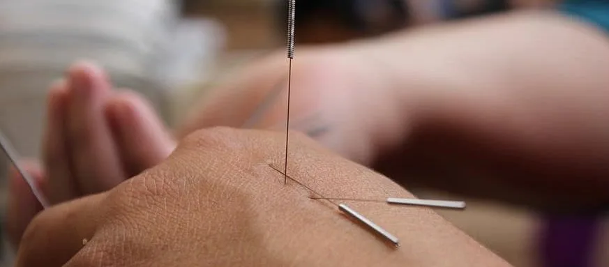 A person carefully uses a needle to create a small hole in their arm, demonstrating a precise and focused action during the acupuncture procedure