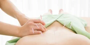 A practitioner performs acupuncture on a patient's back to alleviate pain and promote healing.