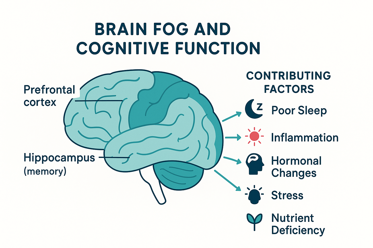 Brain Fog anatomy diagram