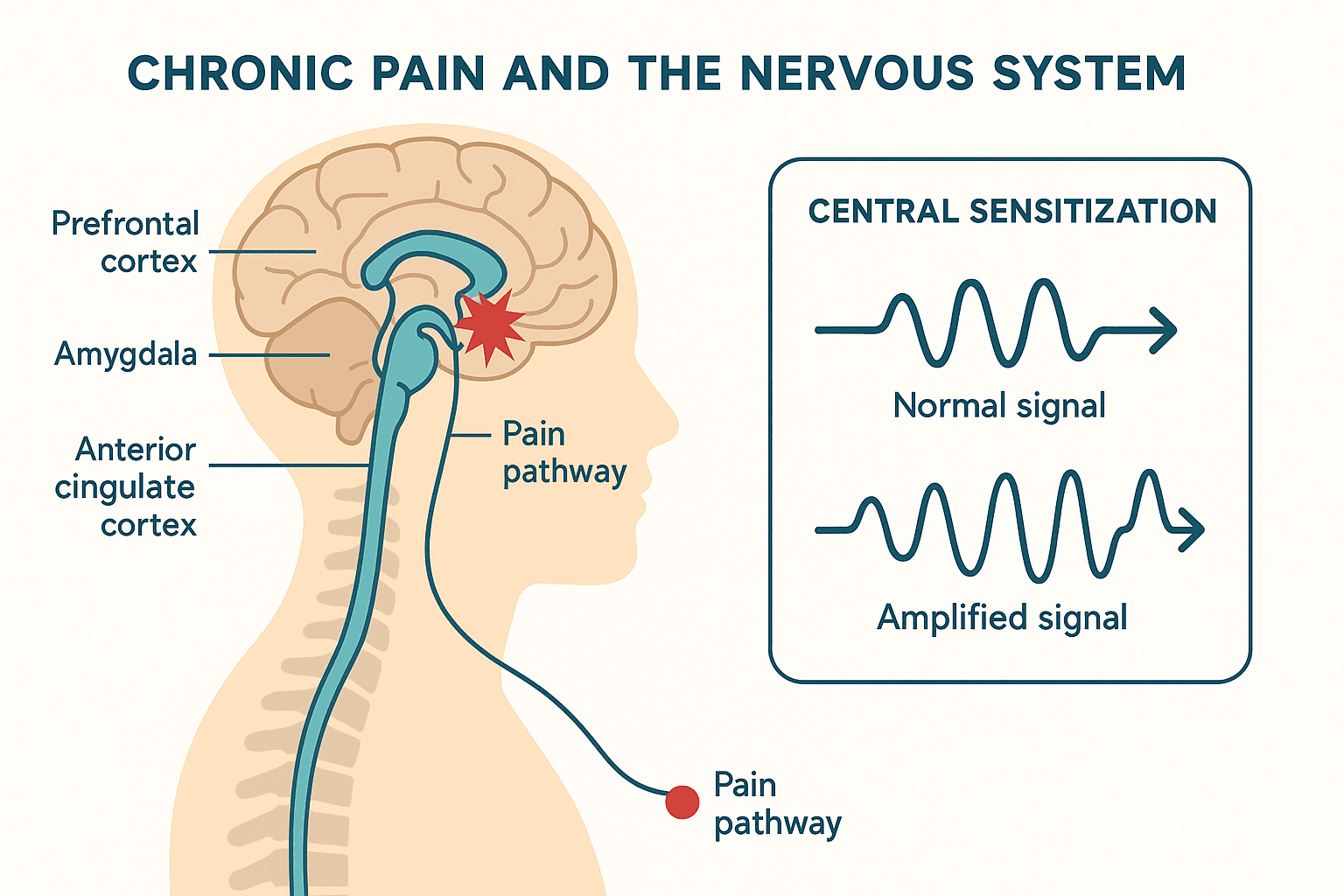Chronic Pain anatomy diagram