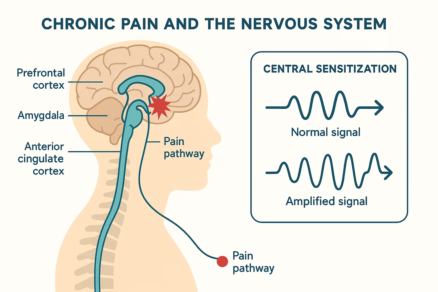 Chronic Pain anatomy diagram