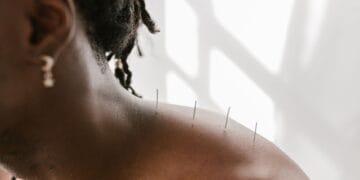 Acupuncture for Menopause: What the Research Actually Says