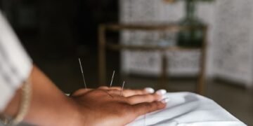 Acupuncture for Anxiety and Stress: What the Evidence Shows